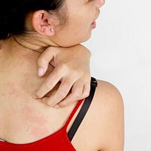 Botox injections may ease psoriasis flare-ups [.title-sm.block.animate.fadeIn]Marotta Plastic Surgery Specialists[]