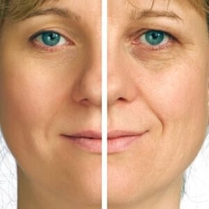 Correct a chronic tired look with a facelift [.title-sm.block.animate.fadeIn]Marotta Plastic Surgery Specialists[]