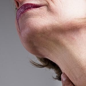 Facial contouring can help with self-esteem after weight loss  [.title-sm.block.animate.fadeIn]Marotta Plastic Surgery Specialists[]