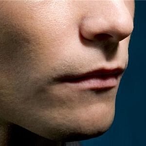 How to determine if you're a good candidate for rhinoplasty [.title-sm.block.animate.fadeIn]Marotta Plastic Surgery Specialists[]