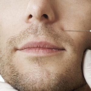 Is Botox a gateway treatment for men? [.title-sm.block.animate.fadeIn]Marotta Plastic Surgery Specialists[]