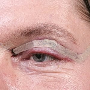 Plastic surgery on the rise among older men [.title-sm.block.animate.fadeIn]Marotta Plastic Surgery Specialists[]