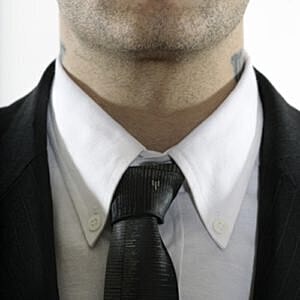 Plastic surgery to remove piercing marks growing in popularity [.title-sm.block.animate.fadeIn]Marotta Plastic Surgery Specialists[]