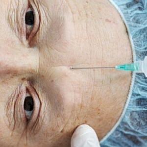 Study shows no additional danger for older plastic surgery patients [.title-sm.block.animate.fadeIn]Marotta Plastic Surgery Specialists[]