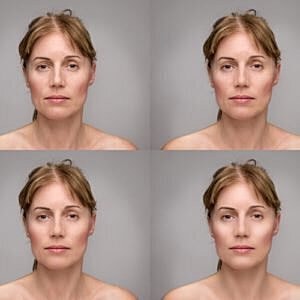 When should I get a facelift? [.title-sm.block.animate.fadeIn]Marotta Plastic Surgery Specialists[]