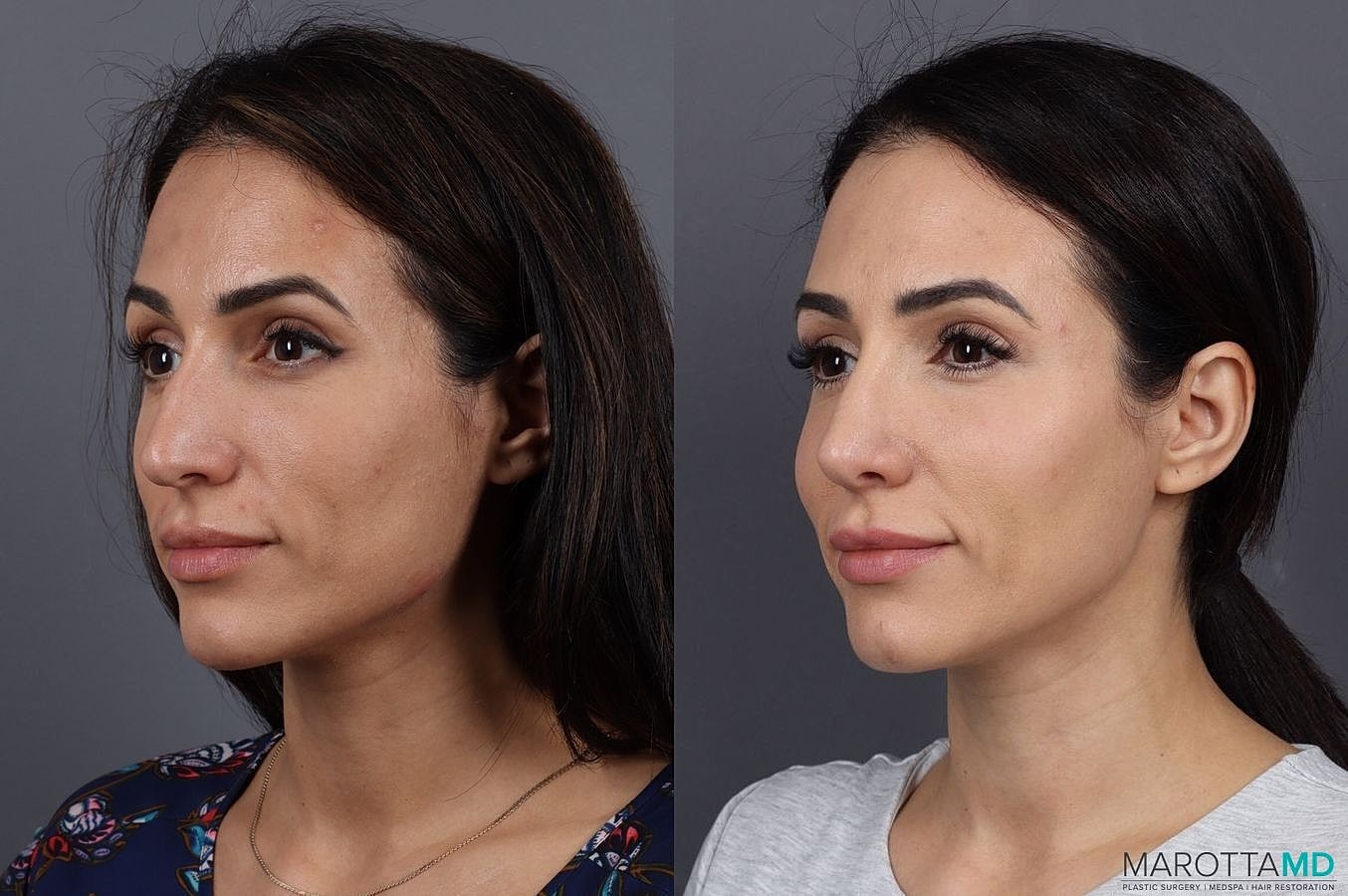 Skinvive Before & After