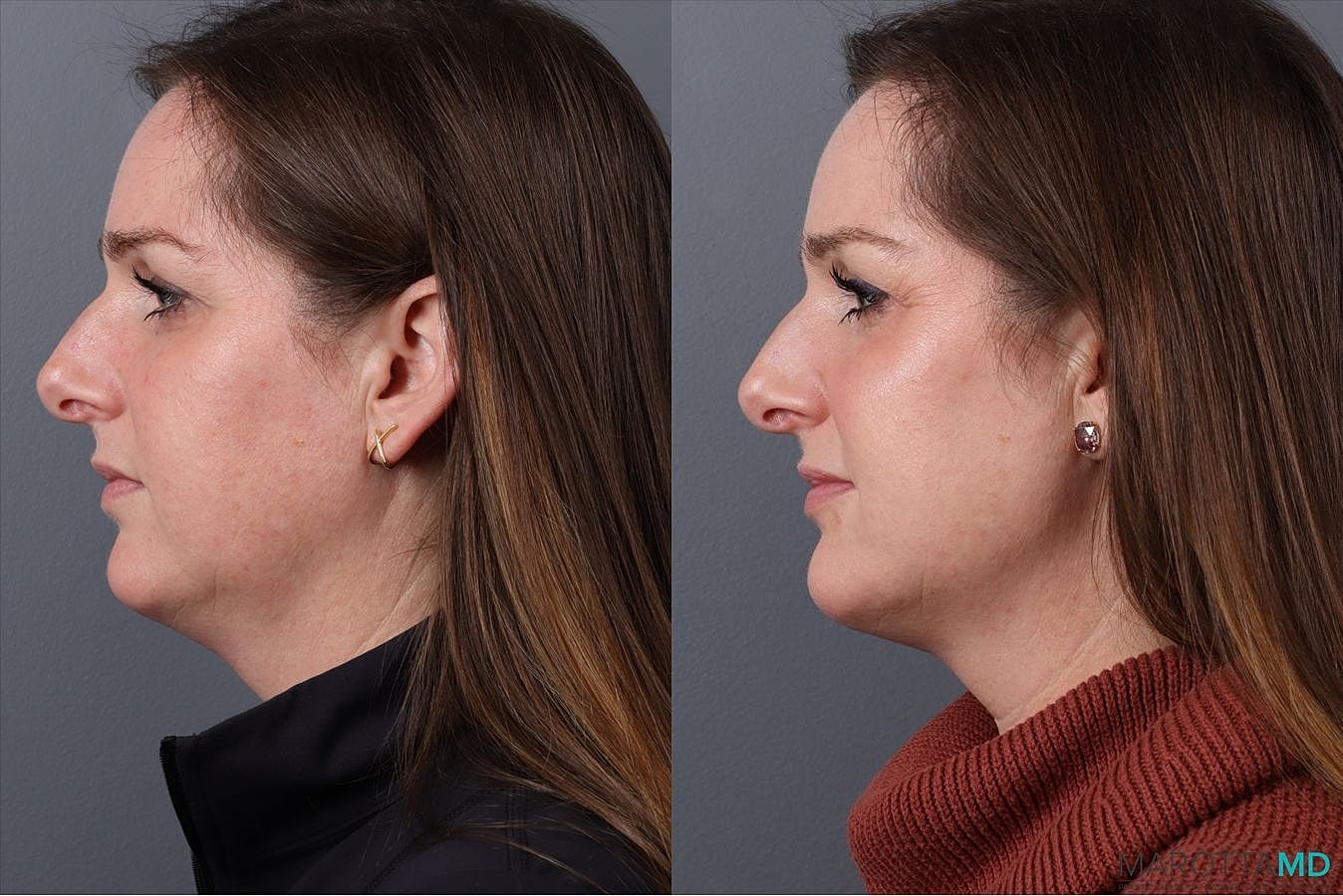 Skinvive Before & After