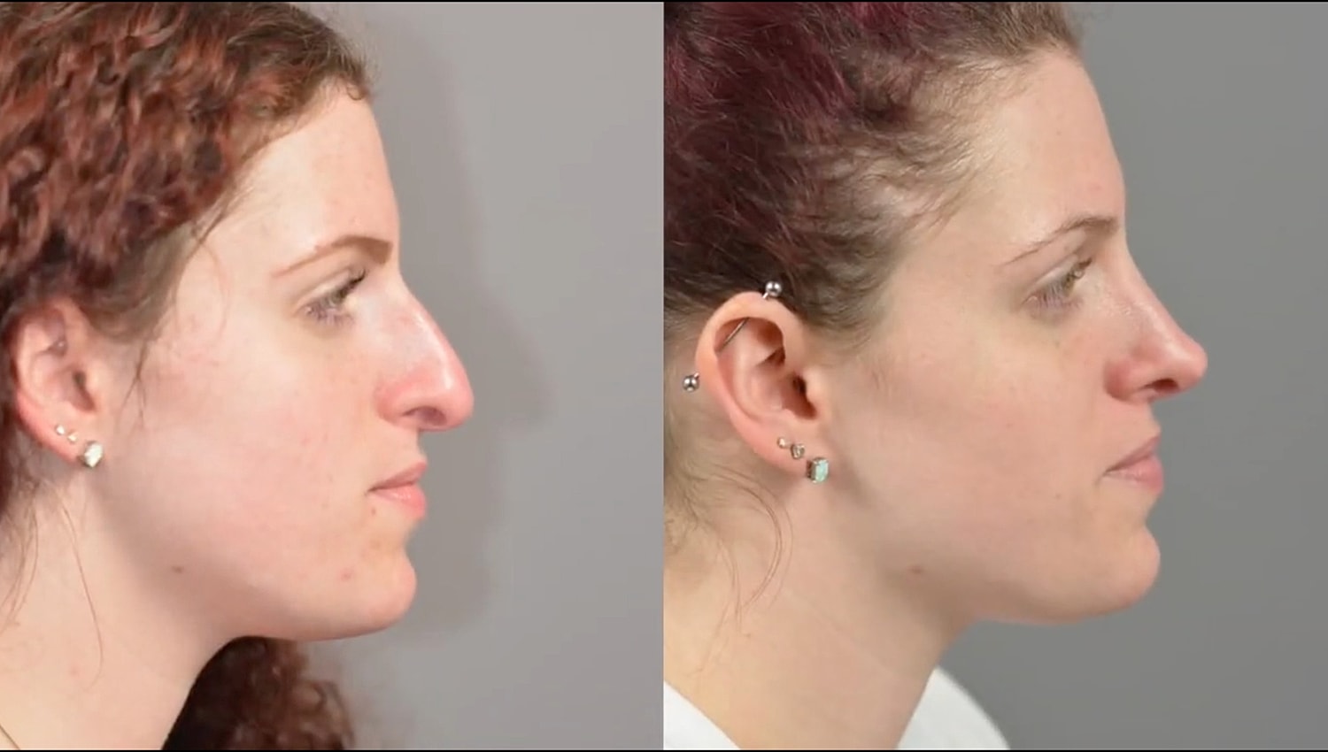 Side profile comparison of two women.
